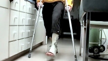 Foot Cast For Poor Evan