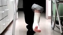 Foot Cast For Poor Evan